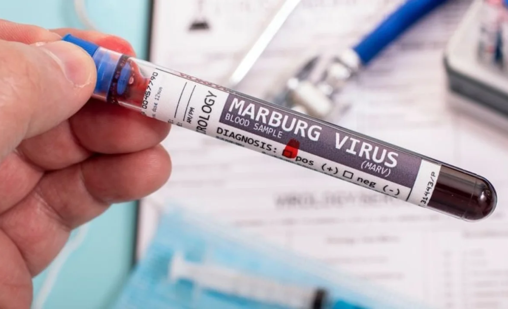 مصر.-وزارة-الصحة-تكشف-حقيقة-وجود-إصابات-“ماربورغ”-بالبلاد