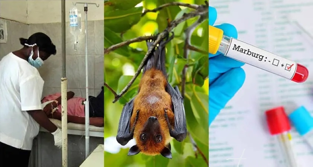 عاجل-|-بسبب-“ماربورغ”.-سفارة-السعودية-تحذر-من-السفر-إلى-“جنوب-أومو”-بإثيوبيا