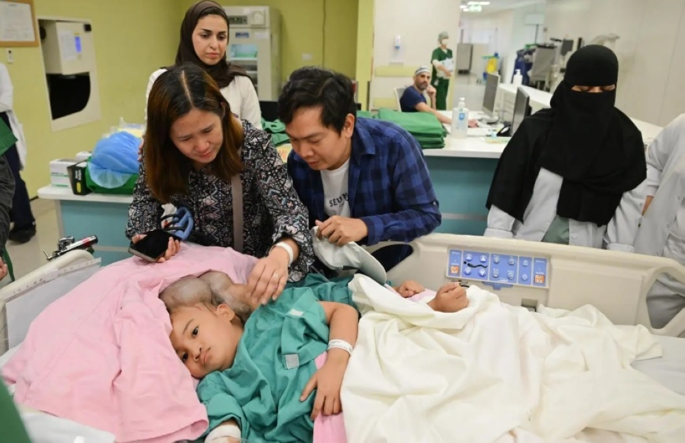 إنفاذًا-لتوجيهات-القيادة.-بدء-عملية-فصل-التوأم-الملتصق-الفلبيني-“كليا-وموريس-آن”-بالرياض