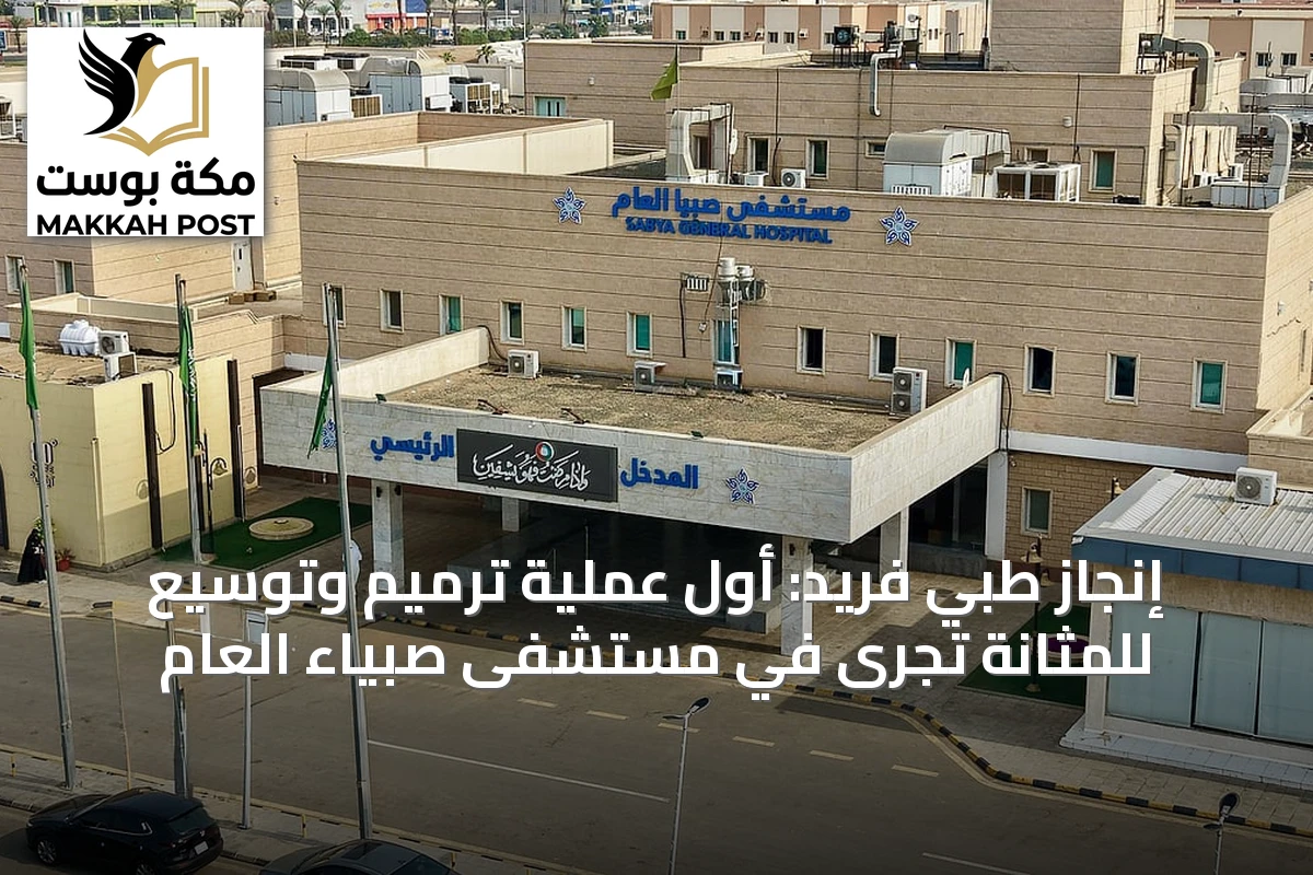 إنجاز طبي فريد: أول عملية ترميم وتوسيع للمثانة تُجرى في مستشفى صبياء العام