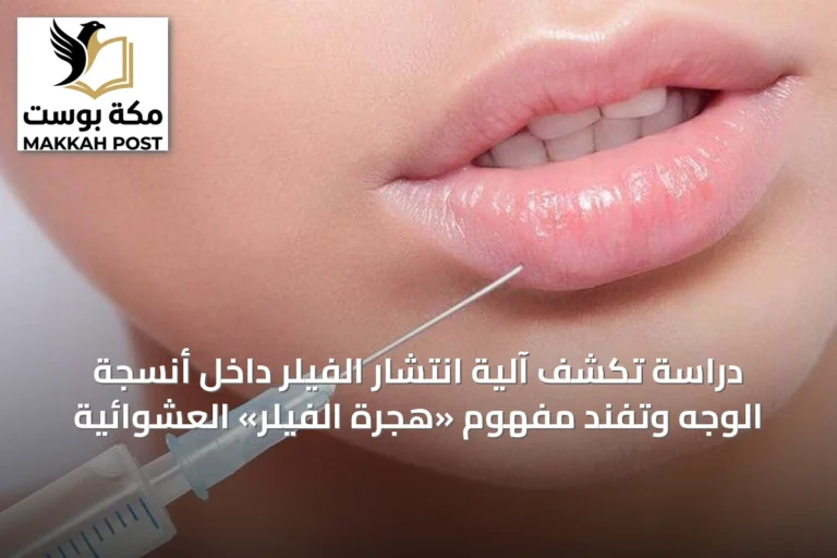 دراسة تكشف آلية انتشار الفيلر داخل أنسجة الوجه وتفند مفهوم «هجرة الفيلر» العشوائية