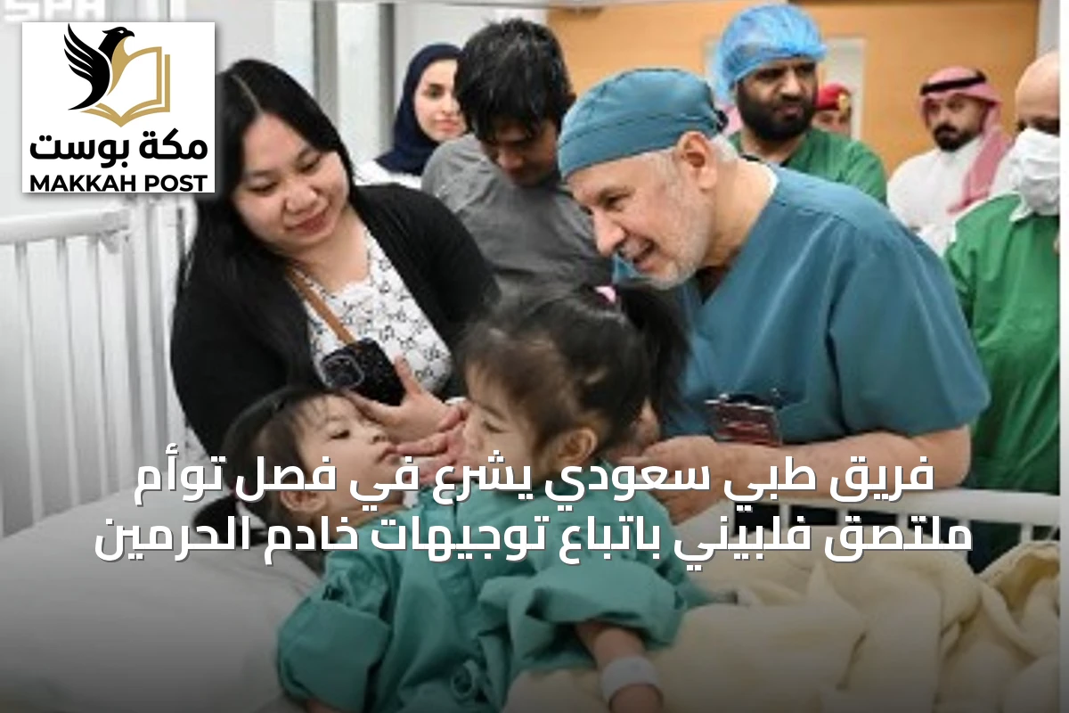 فريق طبي سعودي يشرع في فصل توأم ملتصق فلبيني باتباع توجيهات خادم الحرمين