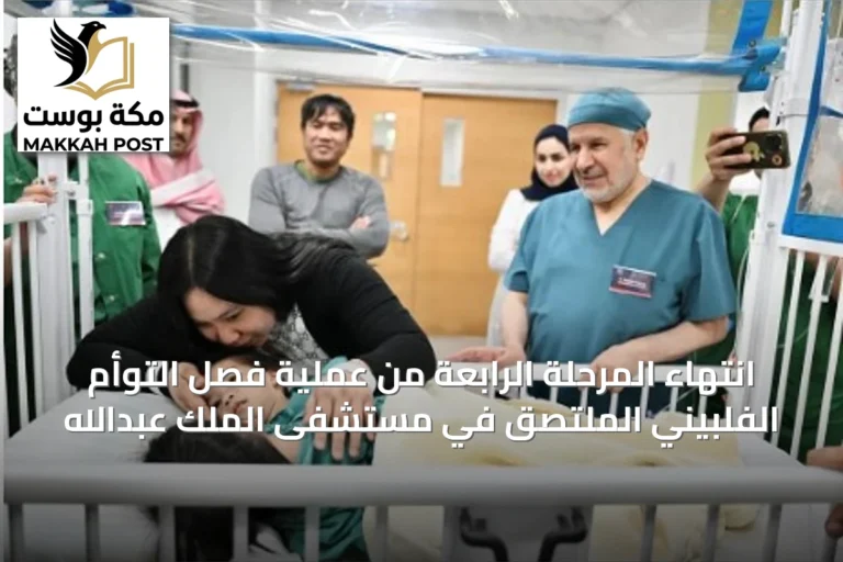 انتهاء المرحلة الرابعة من عملية فصل التوأم الفلبيني الملتصق في مستشفى الملك عبدالله