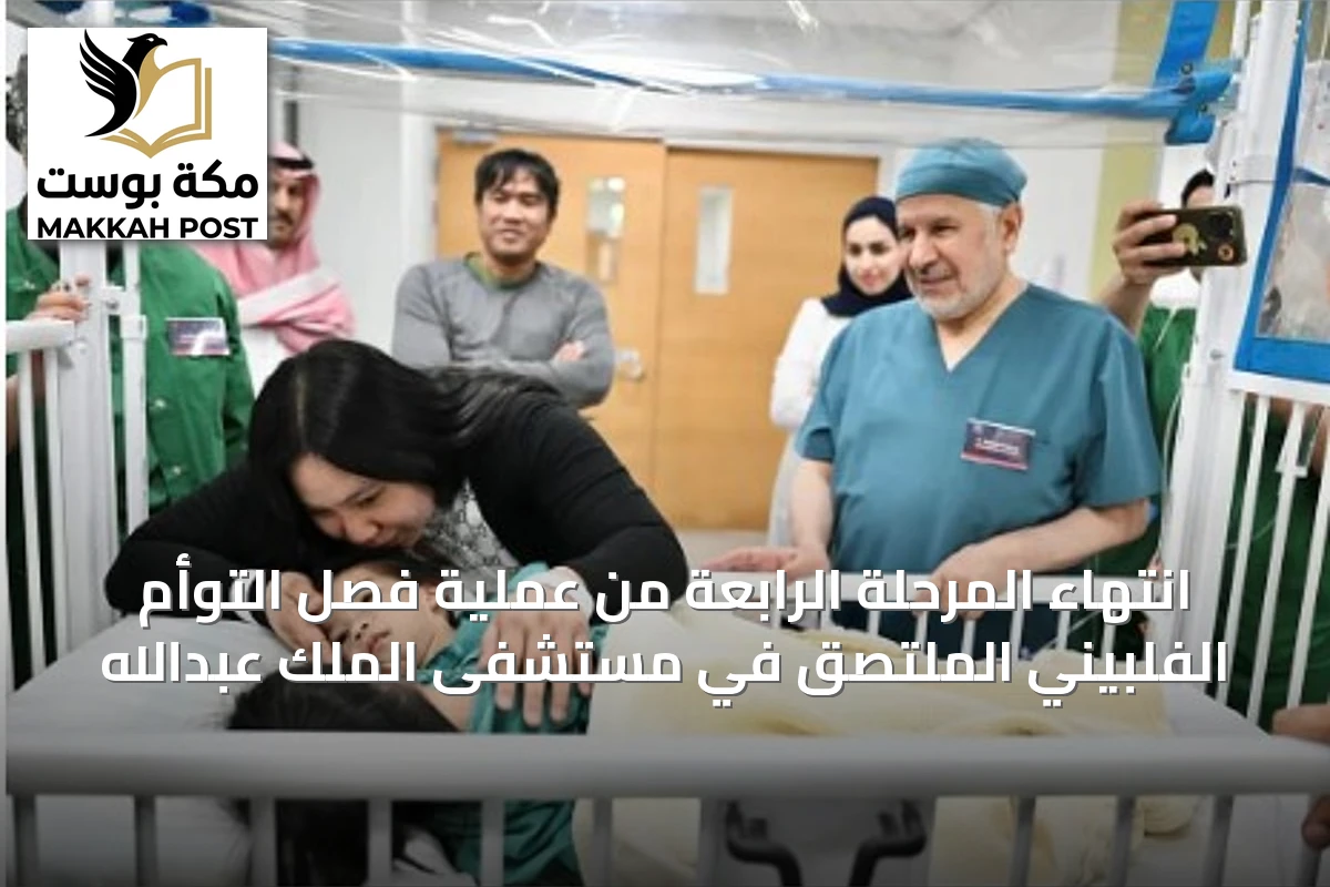 انتهاء المرحلة الرابعة من عملية فصل التوأم الفلبيني الملتصق في مستشفى الملك عبدالله
