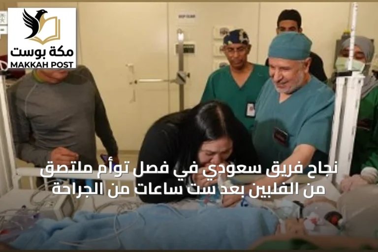 نجاح فريق سعودي في فصل توأم ملتصق من الفلبين بعد ست ساعات من الجراحة
