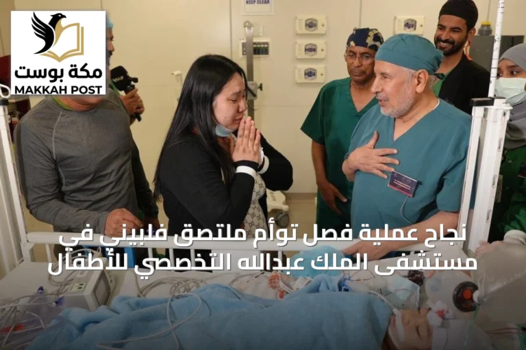 نجاح عملية فصل توأم ملتصق فلبيني في مستشفى الملك عبدالله التخصصي للأطفال