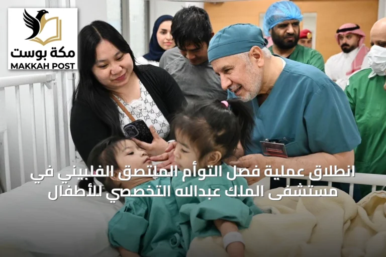 انطلاق عملية فصل التوأم الملتصق الفلبيني في مستشفى الملك عبدالله التخصصي للأطفال