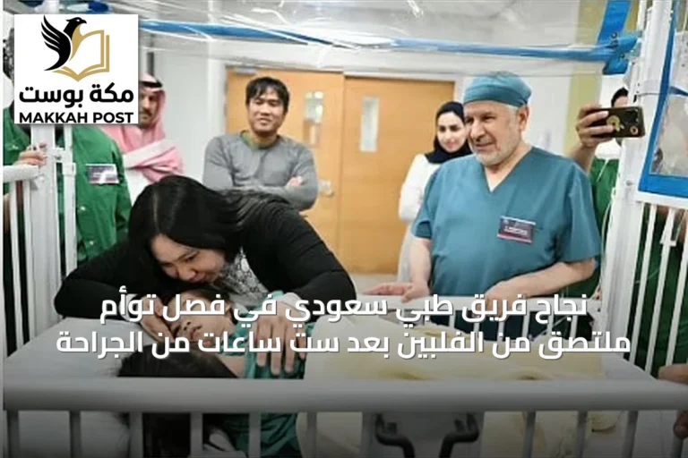 نجاح فريق طبي سعودي في فصل توأم ملتصق من الفلبين بعد ست ساعات من الجراحة