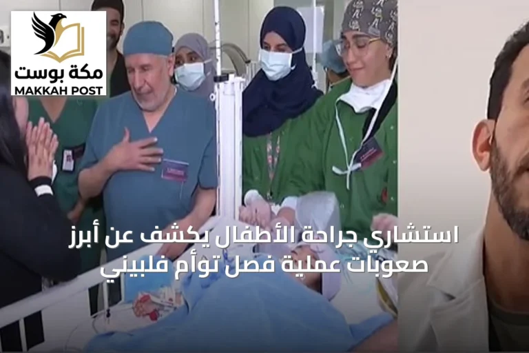 استشاري جراحة الأطفال يكشف عن أبرز صعوبات عملية فصل توأم فلبيني