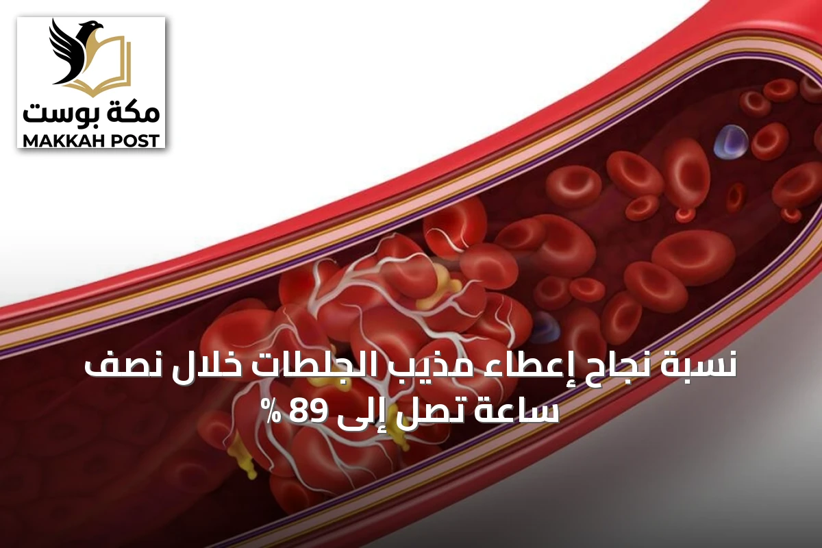 نسبة نجاح إعطاء مذيب الجلطات خلال نصف ساعة تصل إلى 89 %