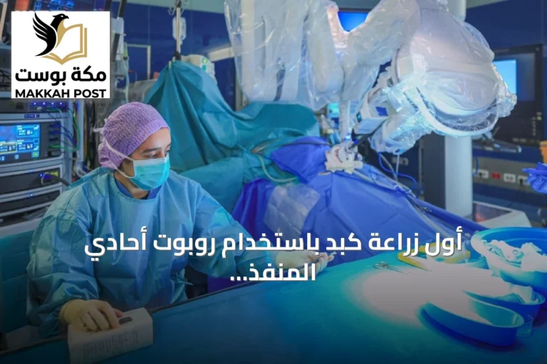 أول زراعة كبد باستخدام روبوت أحادي المنفذ تنجح في مستشفى الملك فيصل التخصصي