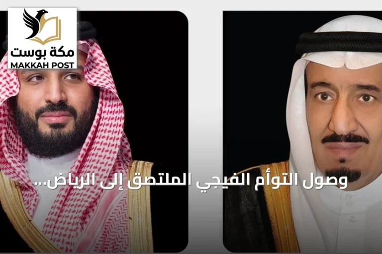 وصول التوأم الفيجي الملتصق إلى الرياض لتقييم إمكانية فصلهما