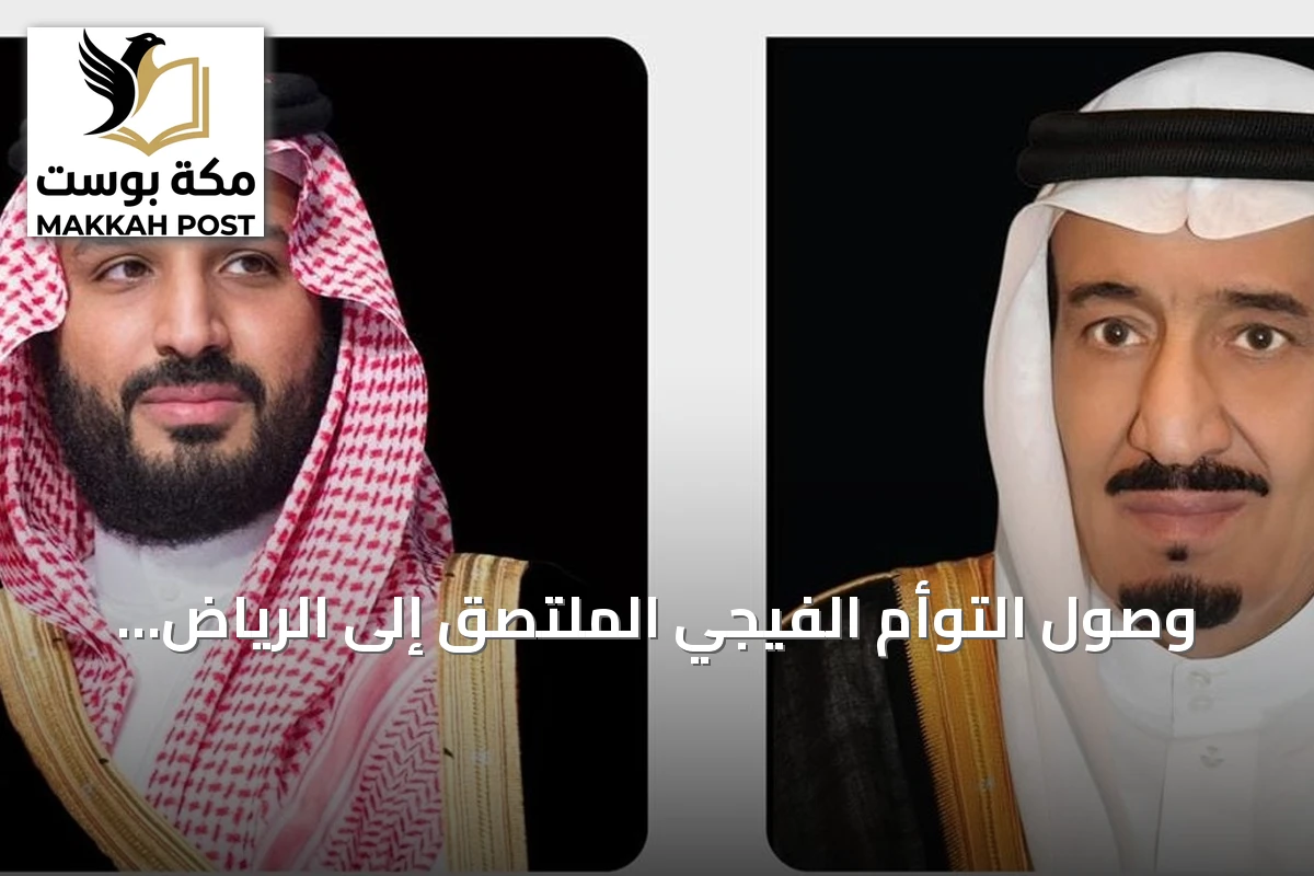 وصول التوأم الفيجي الملتصق إلى الرياض لتقييم إمكانية فصلهما