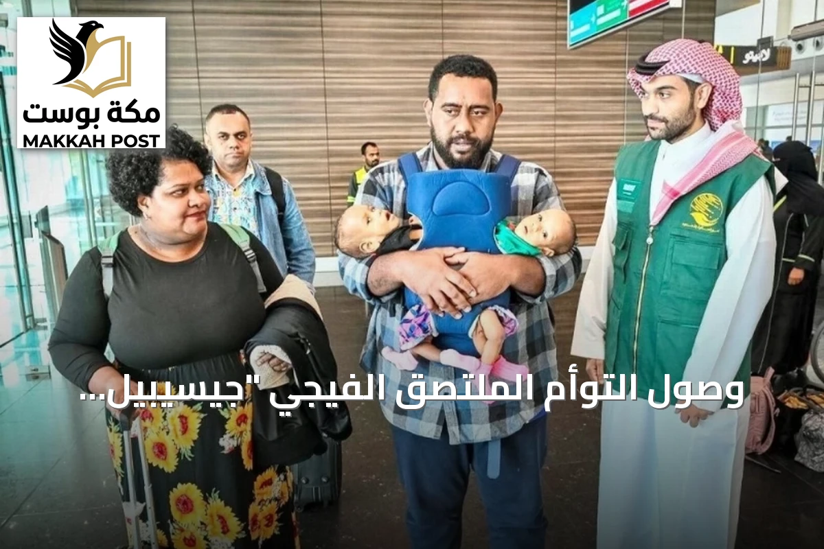وصول التوأم الملتصق الفيجي "جيسيبيل وديسيسيا" إلى الرياض لاستقبال رعاية طبية متخصصة