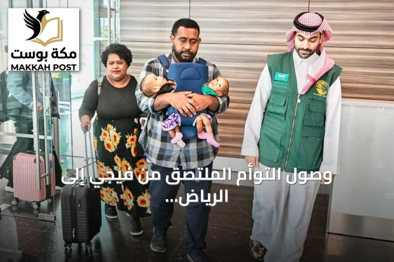 وصول التوأم الملتصق من فيجي إلى الرياض لتقييم حالتهما والتحقق من إمكانية فصلهما
