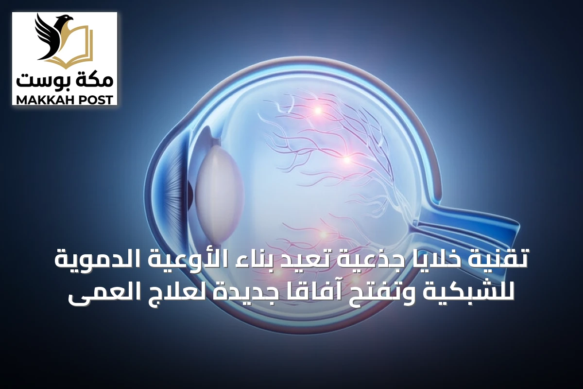 تقنية خلايا جذعية تُعيد بناء الأوعية الدموية للشبكية وتفتح آفاقاً جديدة لعلاج العمى