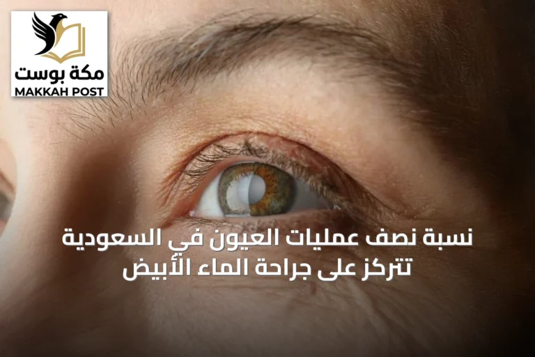 نسبة نصف عمليات العيون في السعودية تتركز على جراحة الماء الأبيض