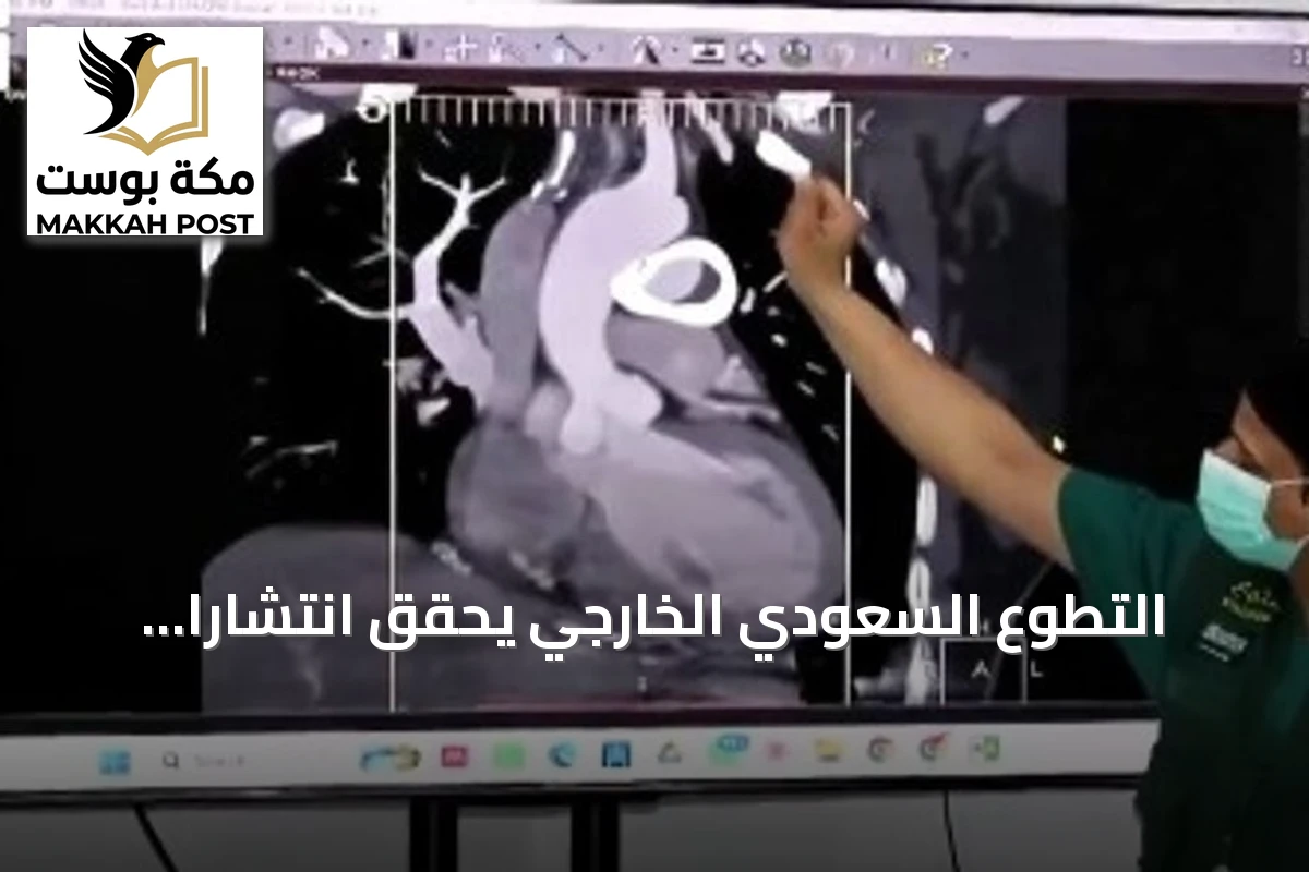 التطوع السعودي الخارجي يحقق انتشاراً عالمياً ويطلق مشروع جراحة قلب أطفال في إندونيسيا
