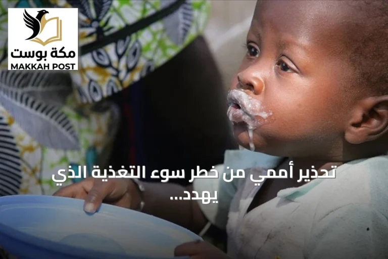 تحذير أممي من خطر سوء التغذية الذي يهدد نحو مليوني طفل صومالي