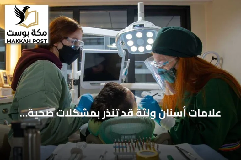 علامات أسنان ولثة قد تنذر بمشكلات صحية خطيرة
