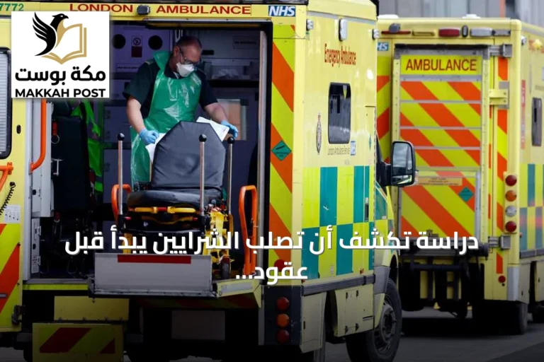 دراسة تكشف أن تصلب الشرايين يبدأ قبل عقود من ظهور الأعراض