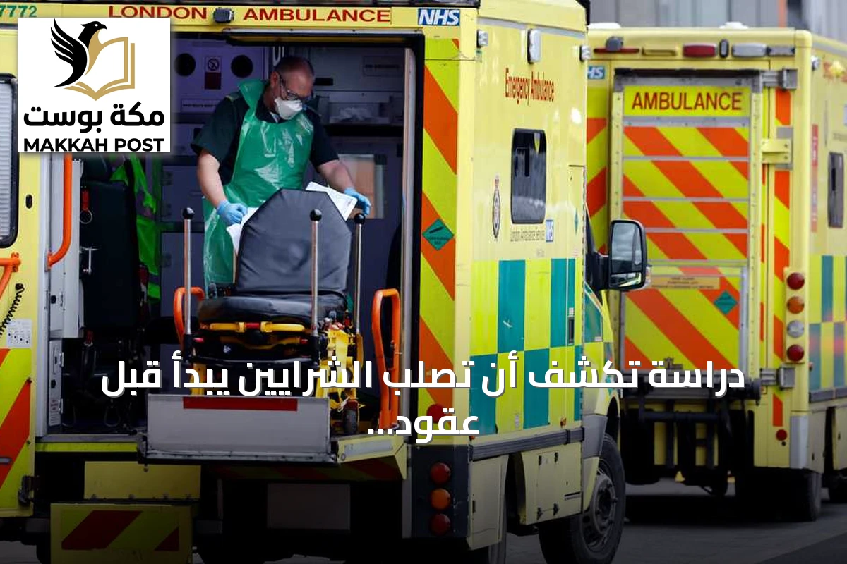 دراسة تكشف أن تصلب الشرايين يبدأ قبل عقود من ظهور الأعراض
