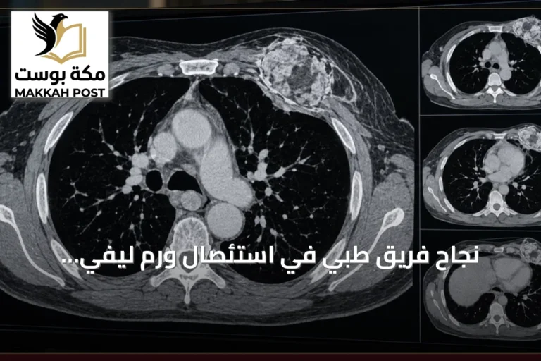 نجاح فريق طبي في استئصال ورم ليفي ديسمويدي نادر من ثدي مريضة وإجراء ترميم فوري باستخدام أنسجة ذاتية