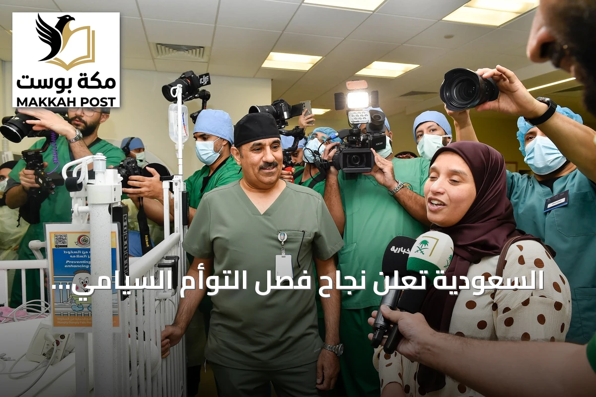 السعودية تعلن نجاح فصل التوأم السيامي المغربي سجى وضحى