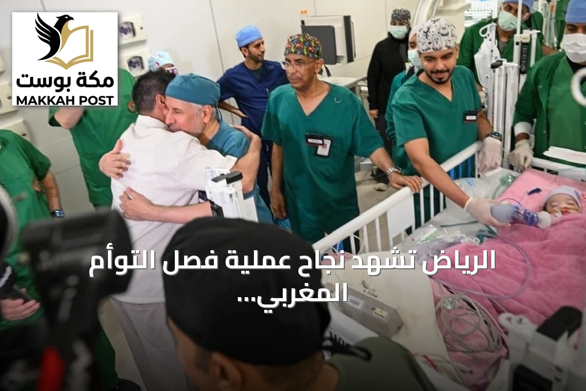 الرياض تشهد نجاح عملية فصل التوأم المغربي سجى وضحى بعد جراحة استمرت ست ساعات