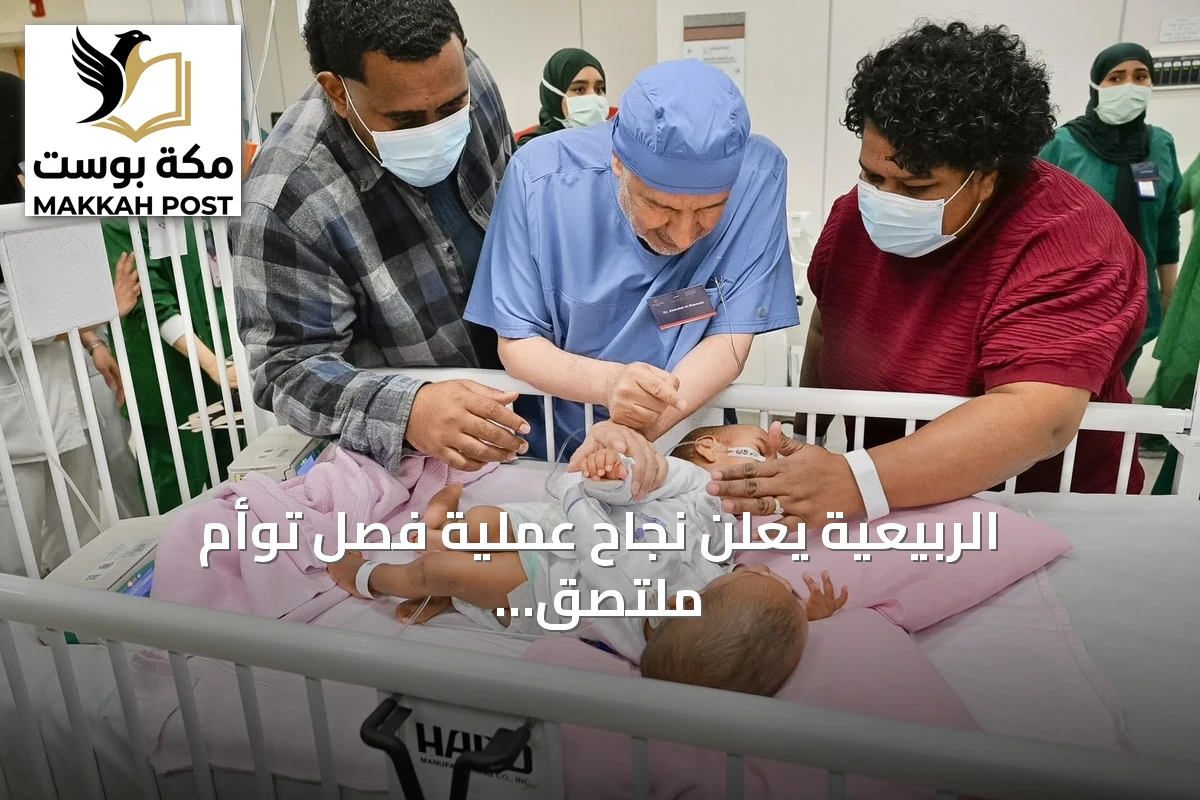 الربيعية يعلن نجاح عملية فصل توأم ملتصق من فيجي في مستشفى الملك Abdullah التخصصي