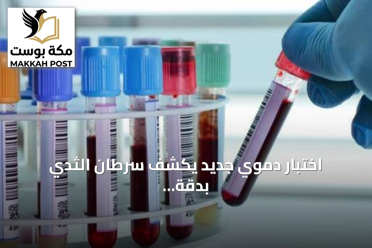 اختبار دموي جديد يكشف سرطان الثدي بدقة عالية